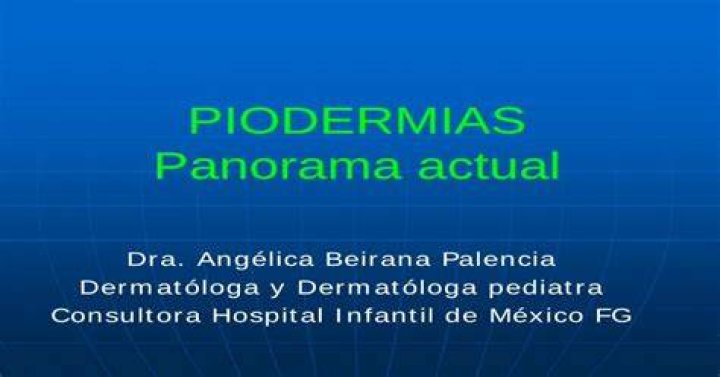 Ang&eacute;lica